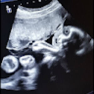 Meet your Posher, Trista